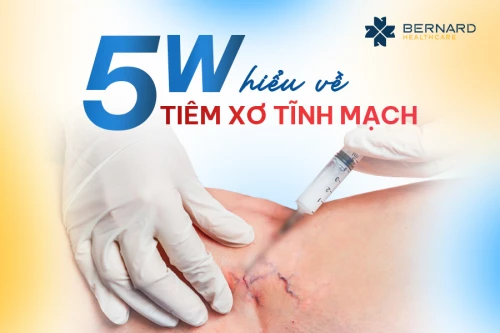 5W hiểu về tiêm xơ tĩnh mạch